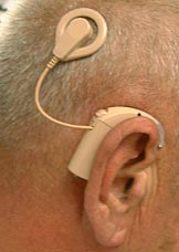 Cochleair implantaat