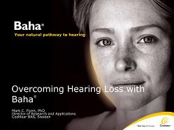 Baha — Your natural pathway to hearing